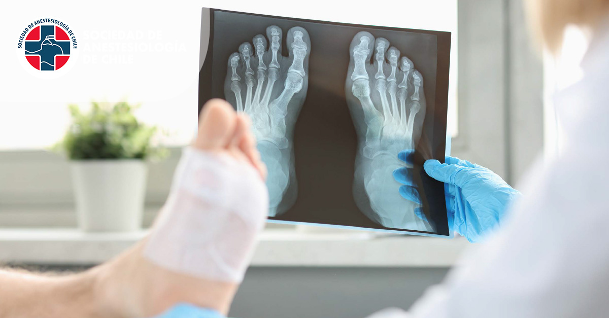 CP4: Anestesia y analgesia para cirugía de Tobillo y Pie